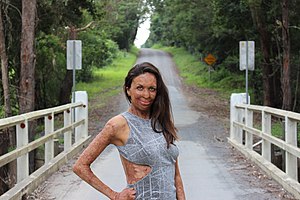 Turia Pitt