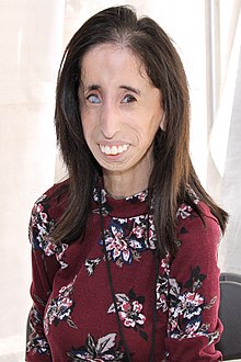 Lizzie Velásquez