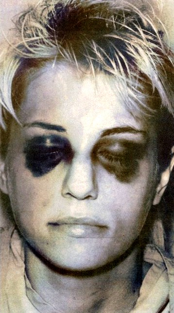 Tammy Homolka